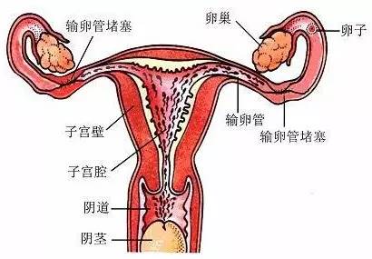 子宫外长肉粒是图片图片
