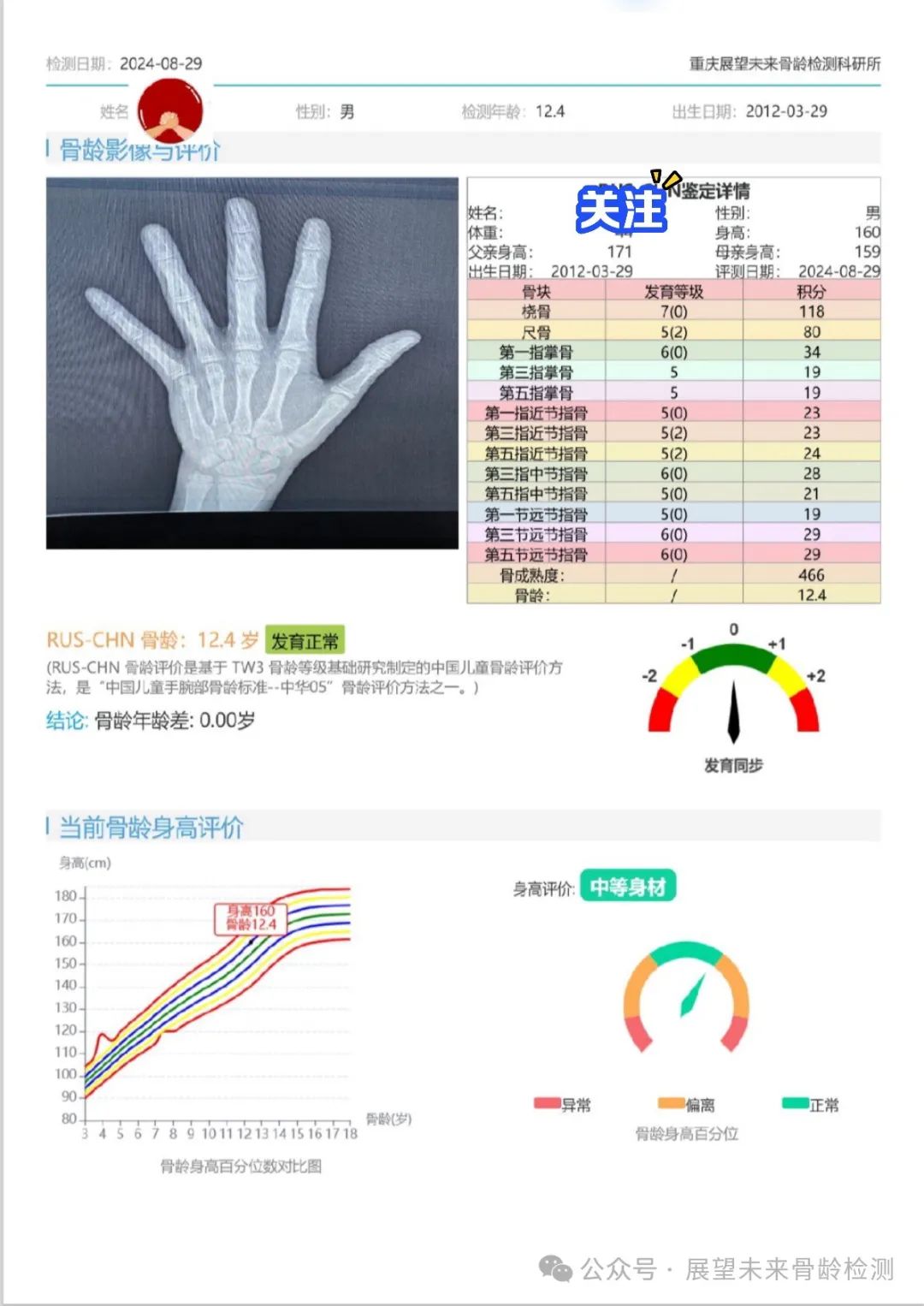 孩子测骨龄 家长如何避坑?