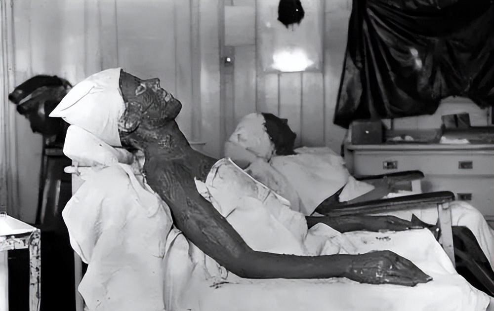 辐射会造成哪些伤害?史上饮用镭水的狠人,下葬后身体还能发热