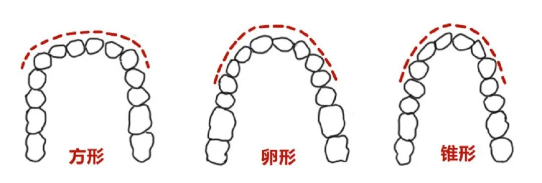 今天的吴宣仪,美到路过的蚂蚁都在夸:搞得值!