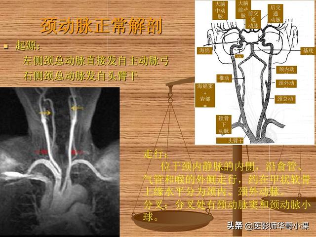 头颈部血管分段以及解剖示意图