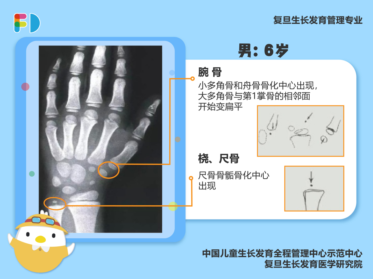 儿童骨龄对照表教你看懂儿童骨龄片