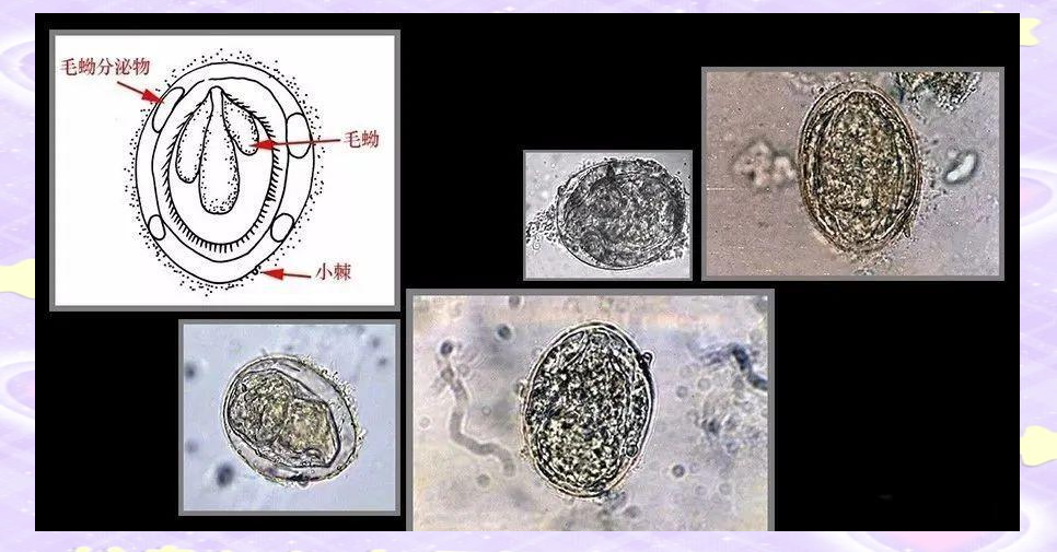 揭秘常见寄生虫卵的形态与大小