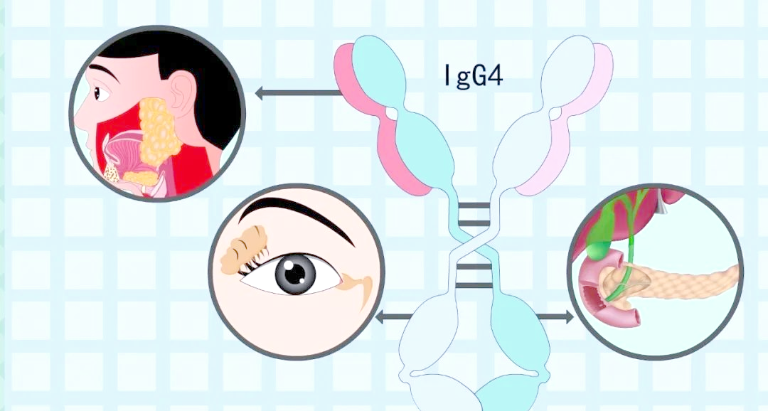 免疫球蛋白IgA、IgG、IgM、IgD、IgE的多样作用与解读