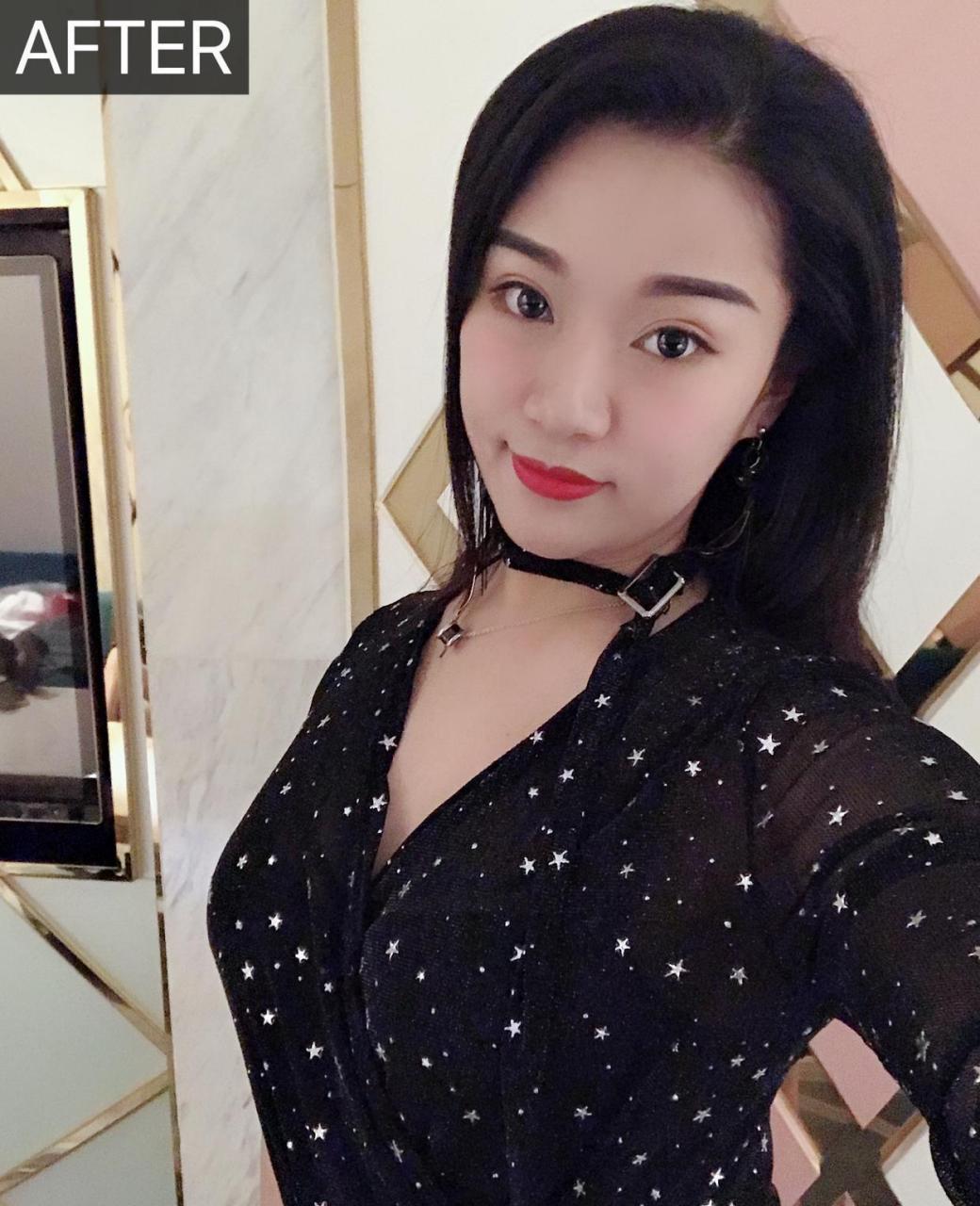 手术前a罩,手术后c罩,你们觉得明显吗.