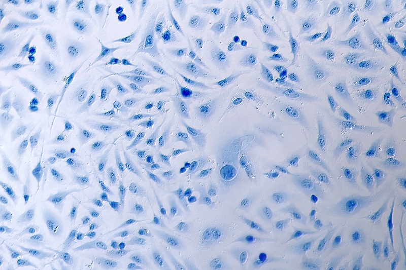 海拉细胞变异图片