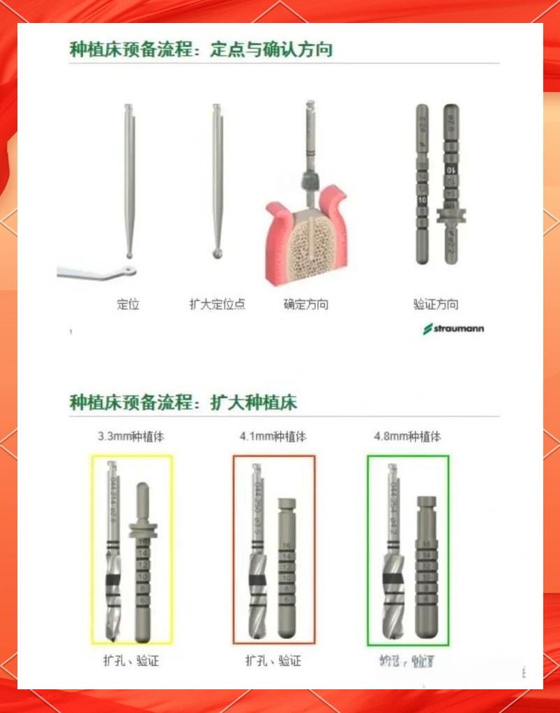 iti种植系统工具盒全面介绍