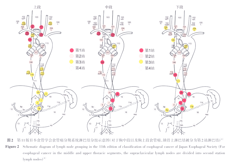食管癌外科治疗中锁骨上淋巴结转移的争议与探讨