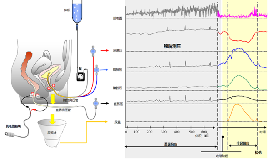 领汇医疗lud4000系列尿动力学分析仪介绍
