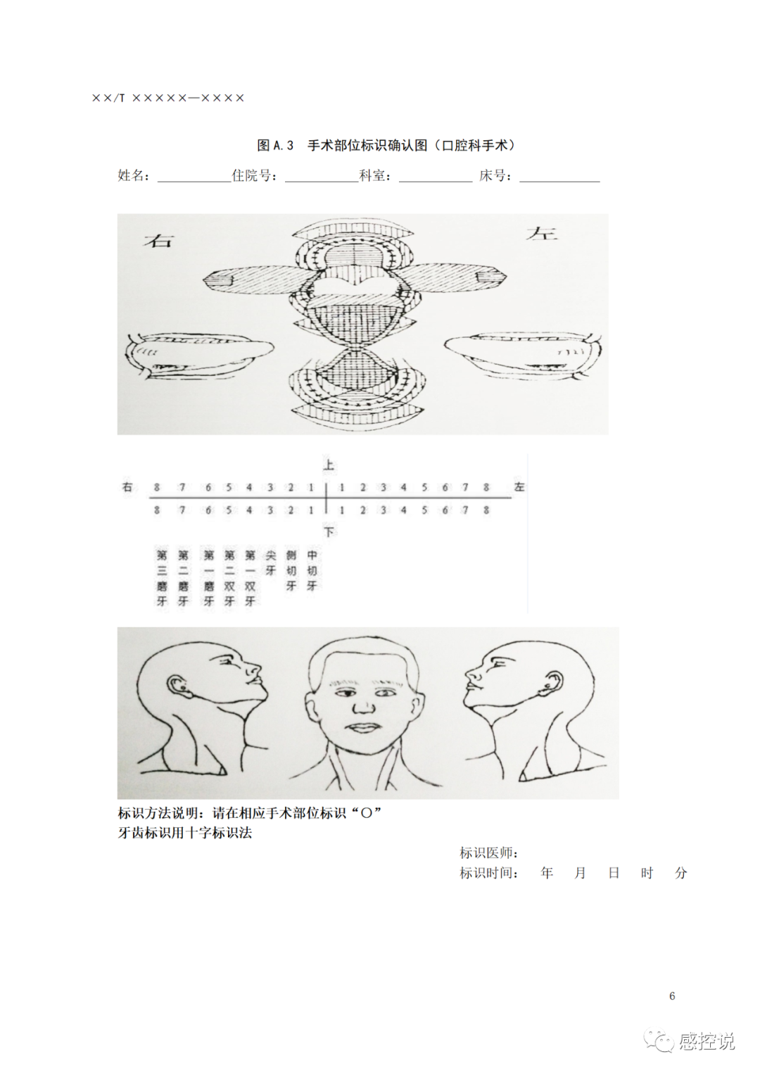 意见稿|手术部位标识规范
