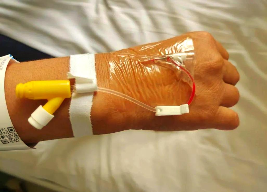 护士与医生合作确保输液安全与冲管细节