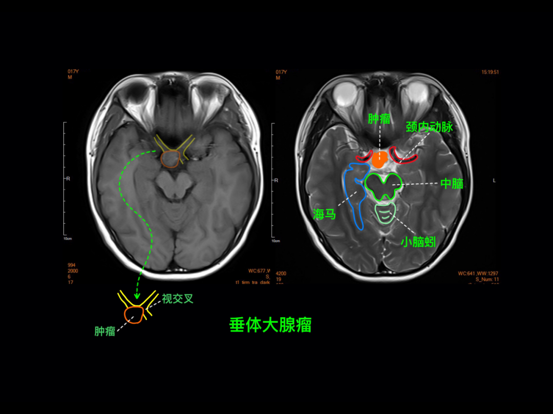 鞍区麻木图片