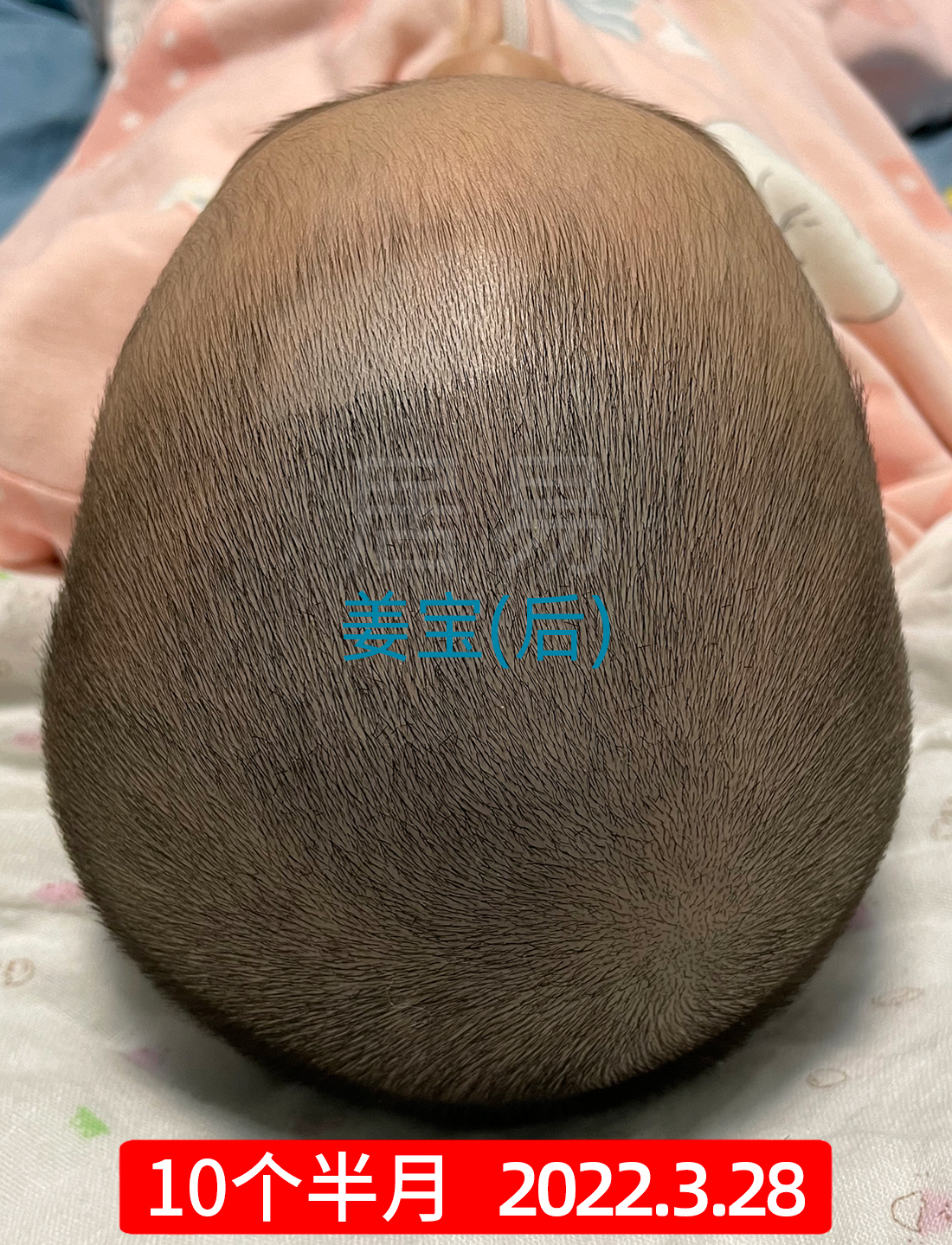 矫正圆头的要点正宗有效的头型矫正指导