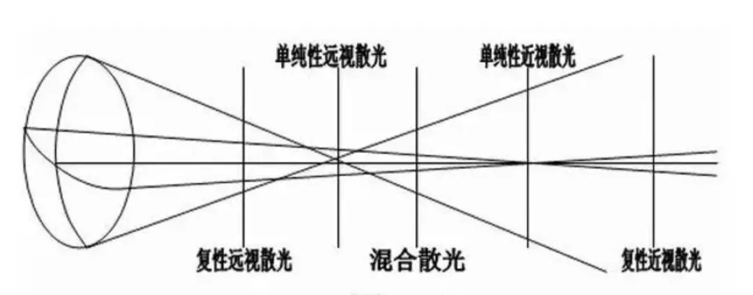 关于散光的危害,新视力自然疗愈为你解答!
