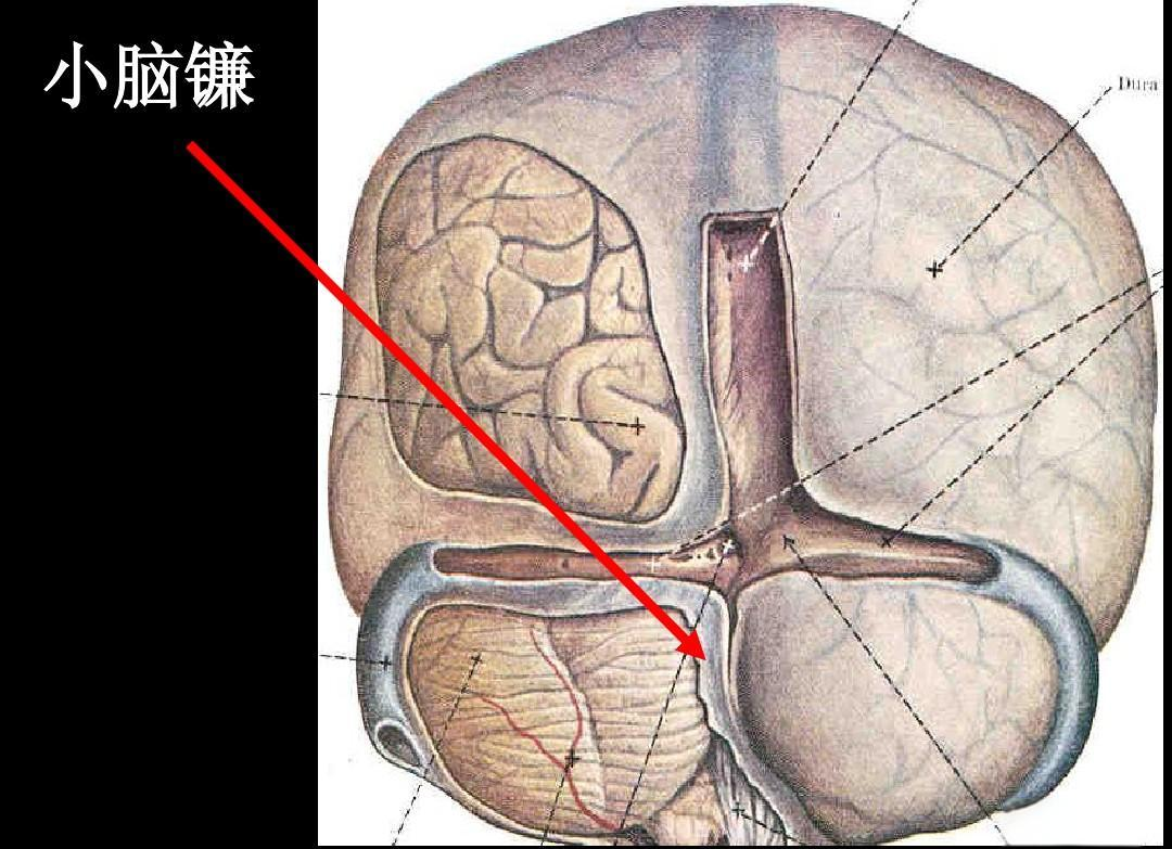 脑室,脑膜,脑池的详细解剖学图集