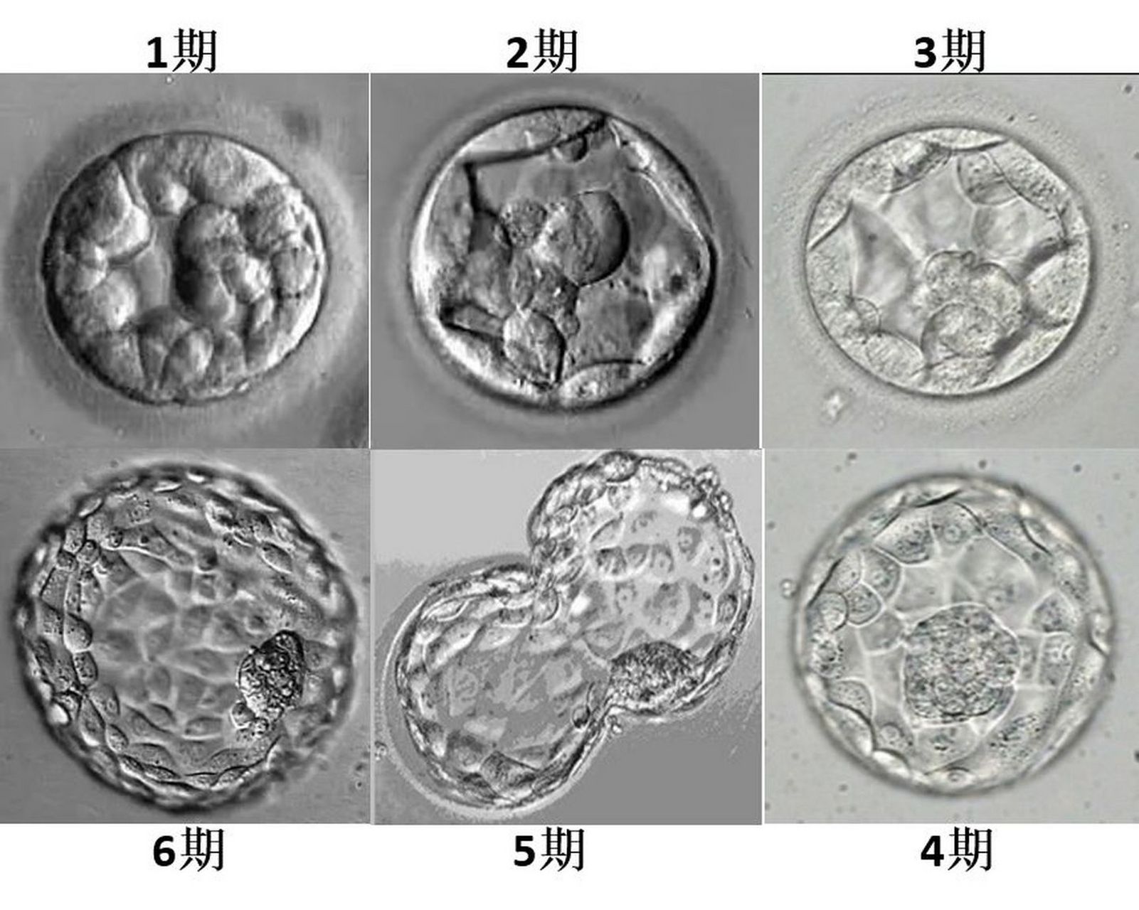 试管婴儿#医生,囊胚移植后几天着床?