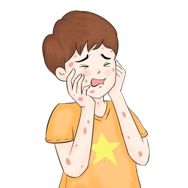 牛皮癣治疗半途而废,危害超出你想象,主要影响有3点!