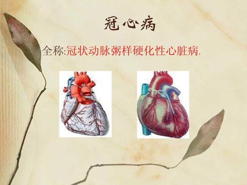 心脏部位经常隐隐疼痛,是得了心脏病吗?做什么检查才能确诊?