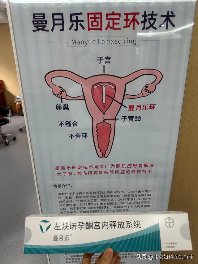 曼月乐环固定方案:为女性健康带来新希望