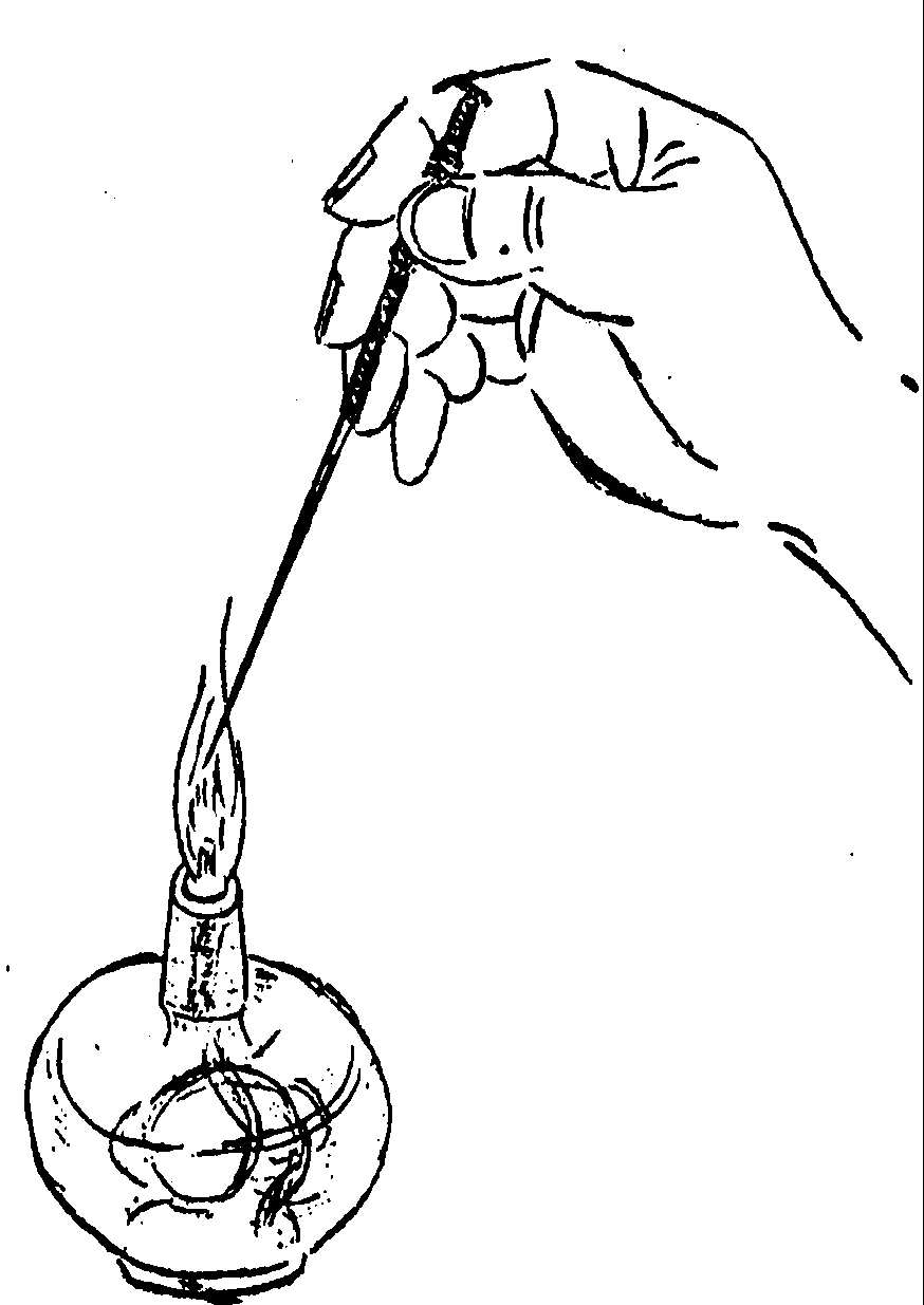 皮肤科医生详解:带状疱疹("缠腰蛇")的认知与治疗