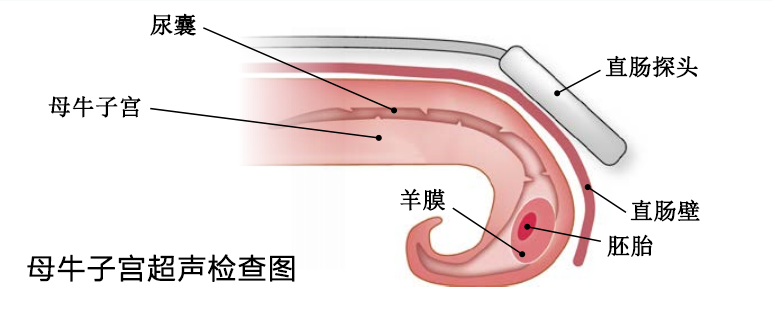 牛用b超机检测母牛子宫超声图