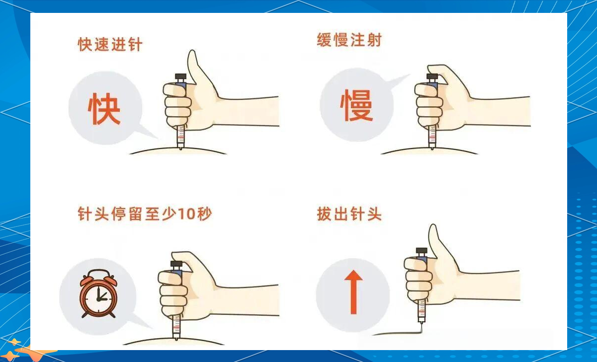 胰岛素注射的规范指南与技巧
