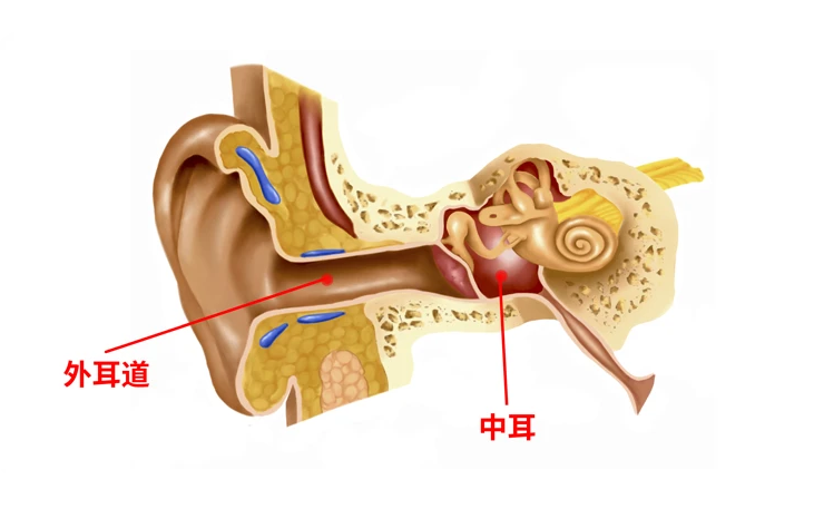 区分油耳和中耳炎图片图片