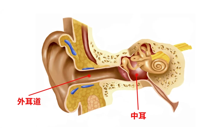「科普」外耳道炎和中耳炎区别