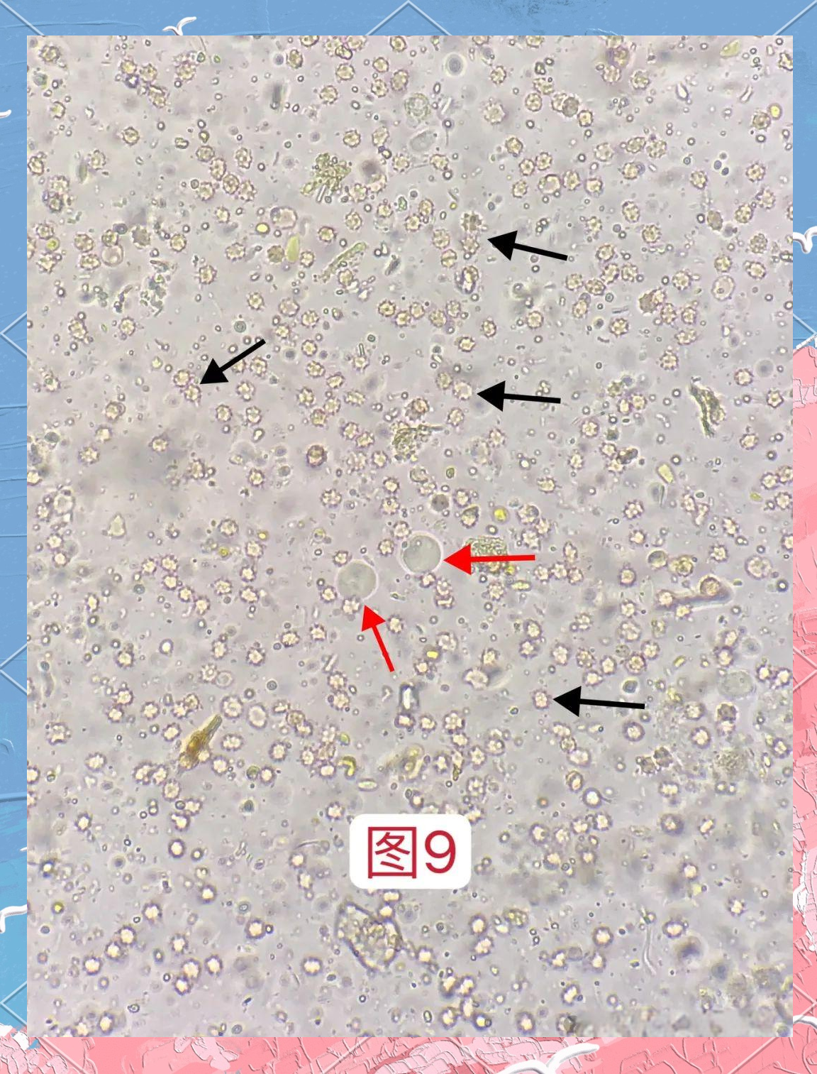 粪便中的微观世界:人芽囊原虫与植物细胞的对比