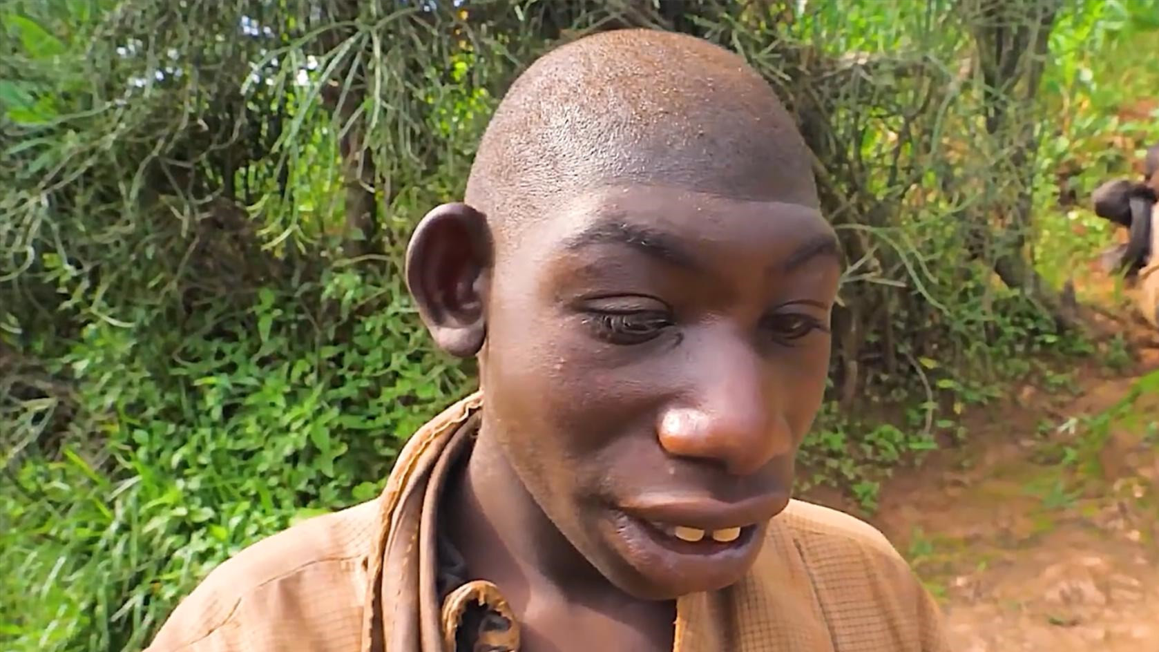 受人欺负的猴子男孩,没想到一夜走红网络,母亲对他一直不离不弃