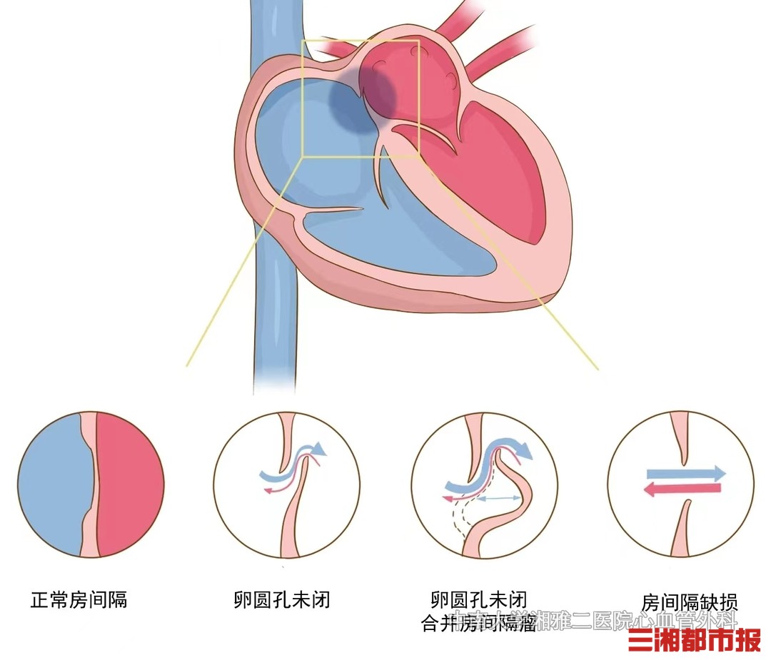 经常头晕?要留意是不是多了个小心眼