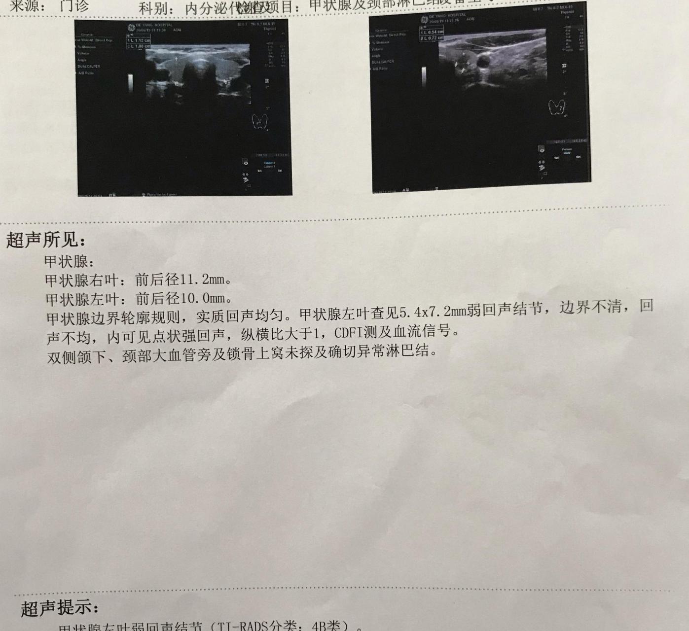 但除了看分级标准外,这些也能帮助我们初步判断甲状腺结节严重程度.