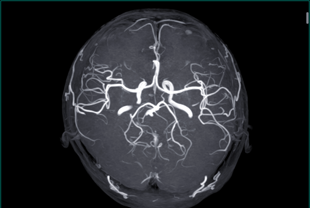 核磁共振价格为什么这么贵为什么在线