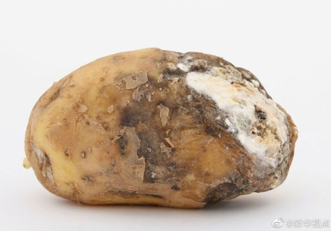 肿瘤专家称黄曲霉素与肝癌密切相关