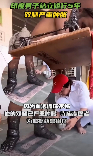 站立五年不坐不躺！印度苦行僧双腿严重发黑肿胀 还要再熬7年