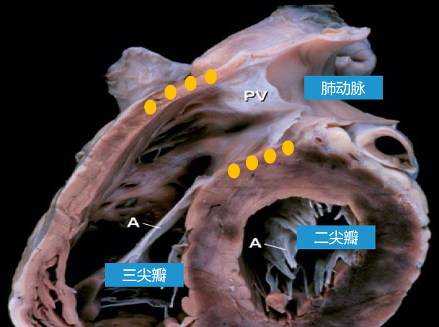 动脉圆锥在哪里?有什么用?
