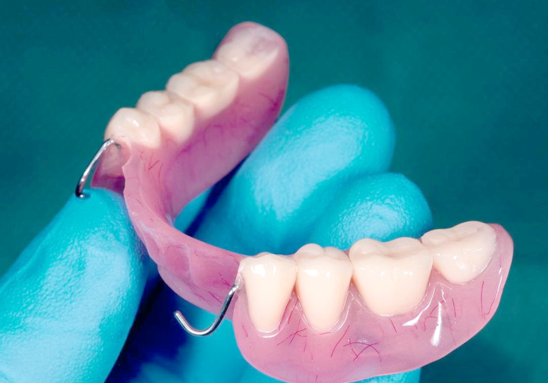 假牙相关图片4