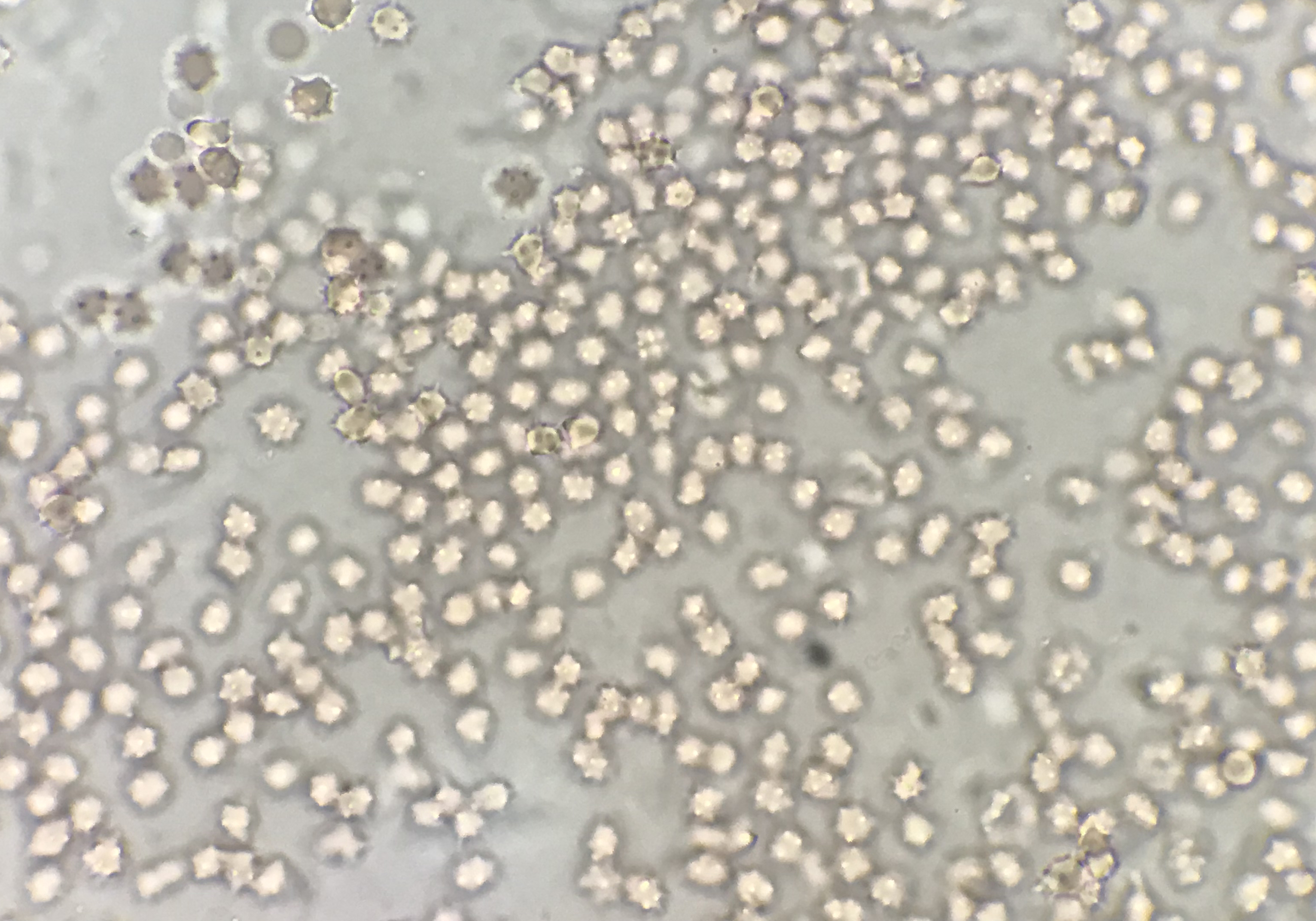 夏季—猪血虫病要警惕