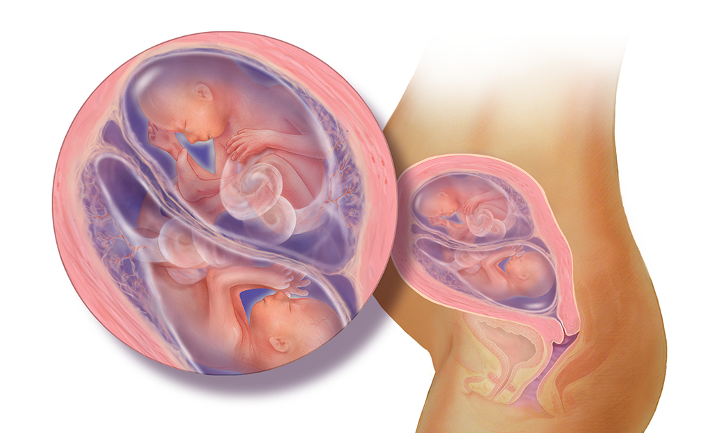 双胞胎在同一个胎盘里,为什么会出现一个大一个小的情况?