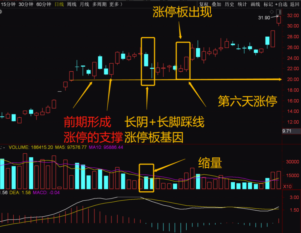 股票大长腿的图形图片