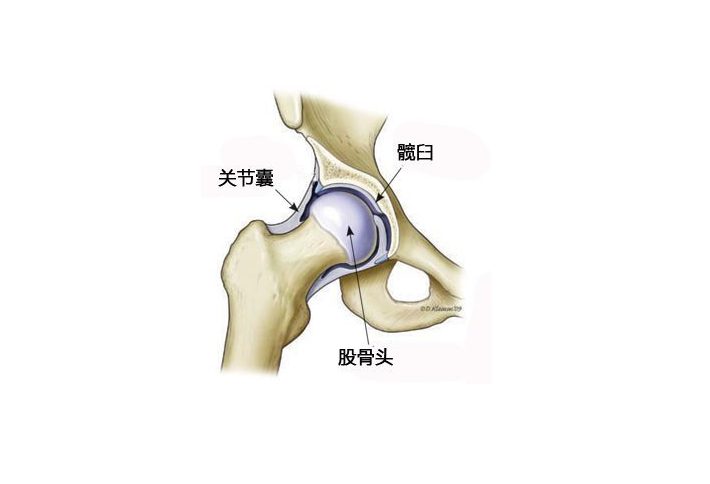 髖關節滑膜炎的治療方法和日常保養