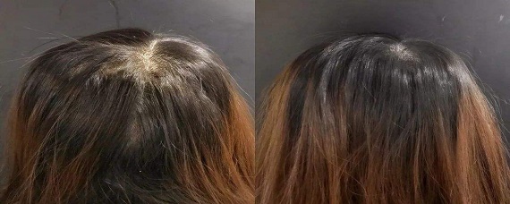 头发老出油试试这5招