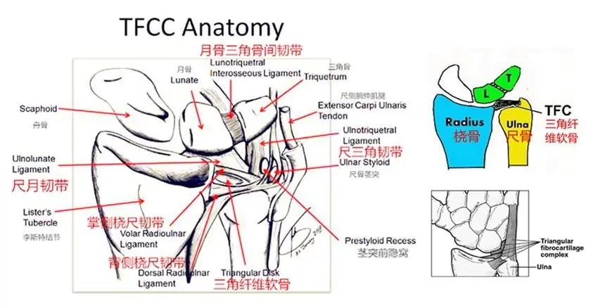 容易被忽視,漏診的腕關節外傷:下尺橈關節脫位