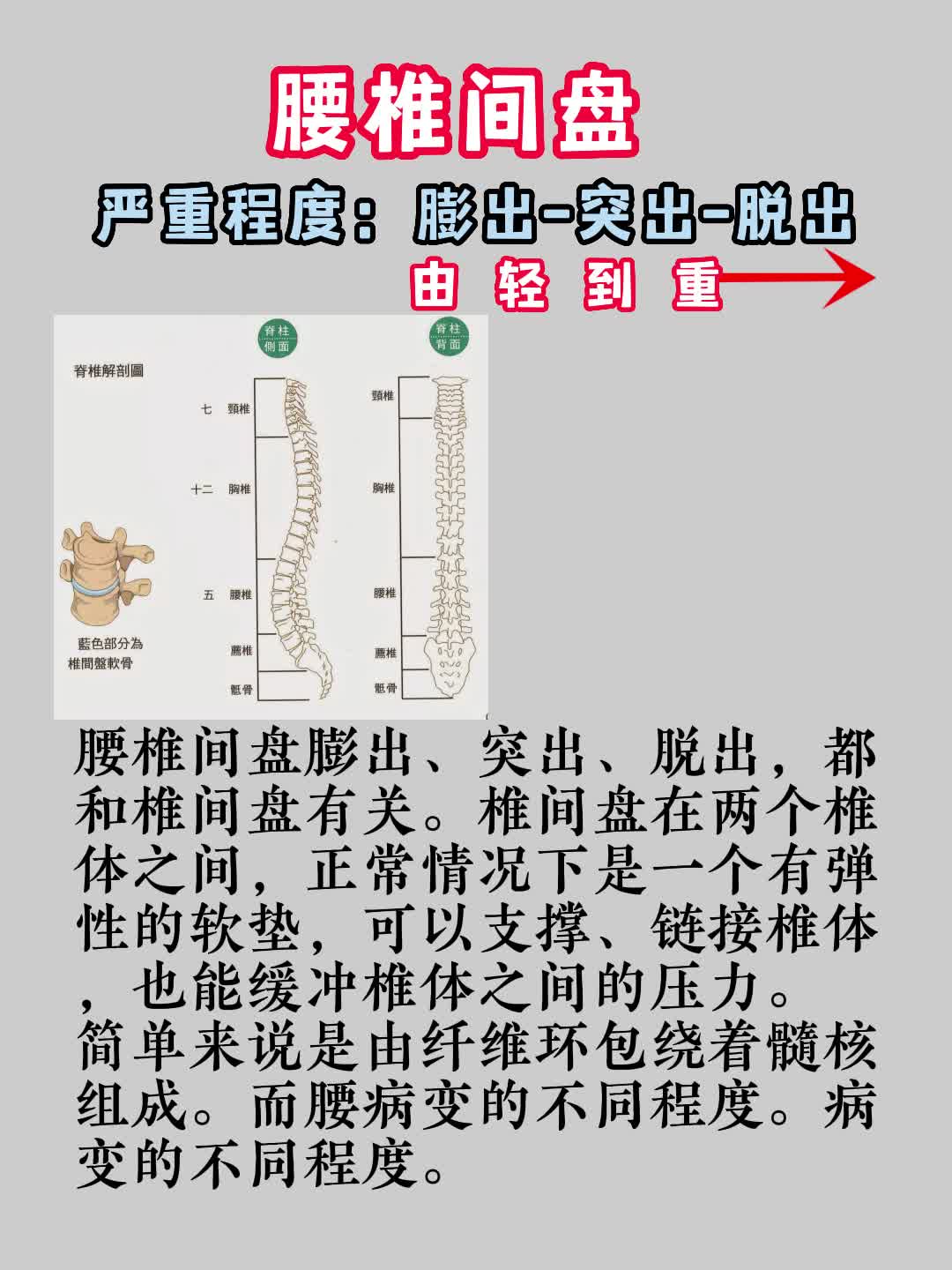 腰椎间盘脱出,突出,膨出?傻傻分不清楚?