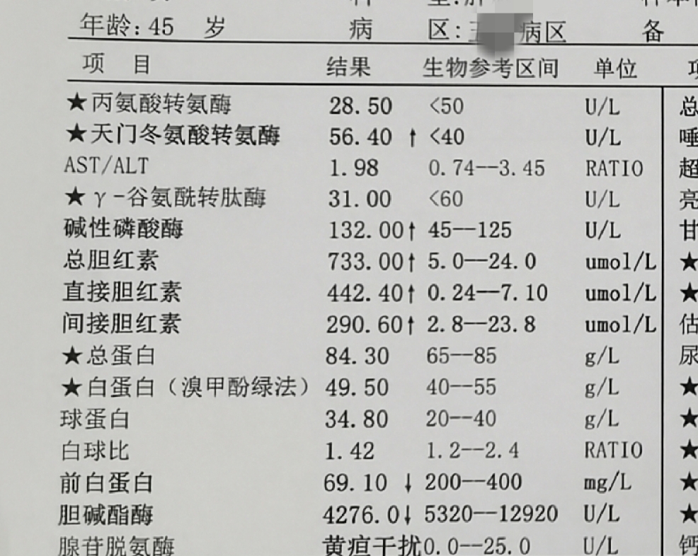 胆红素升高多半是肝脏出问题了