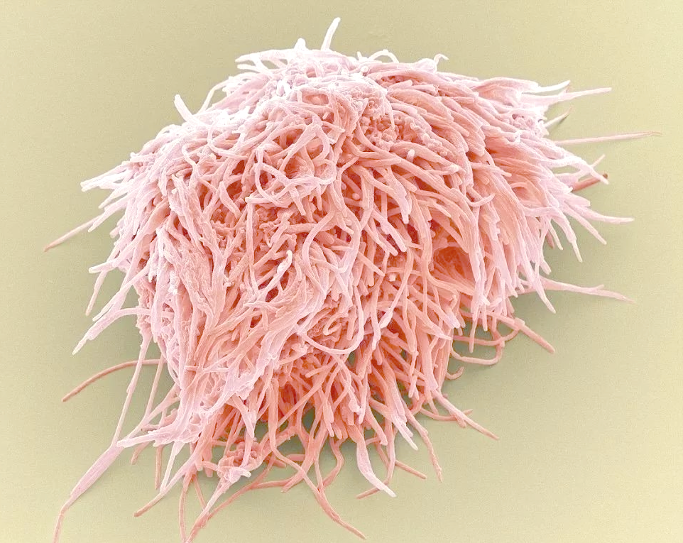 放大1000倍揭示细菌世界:激发孩子养成良好口腔卫生习惯