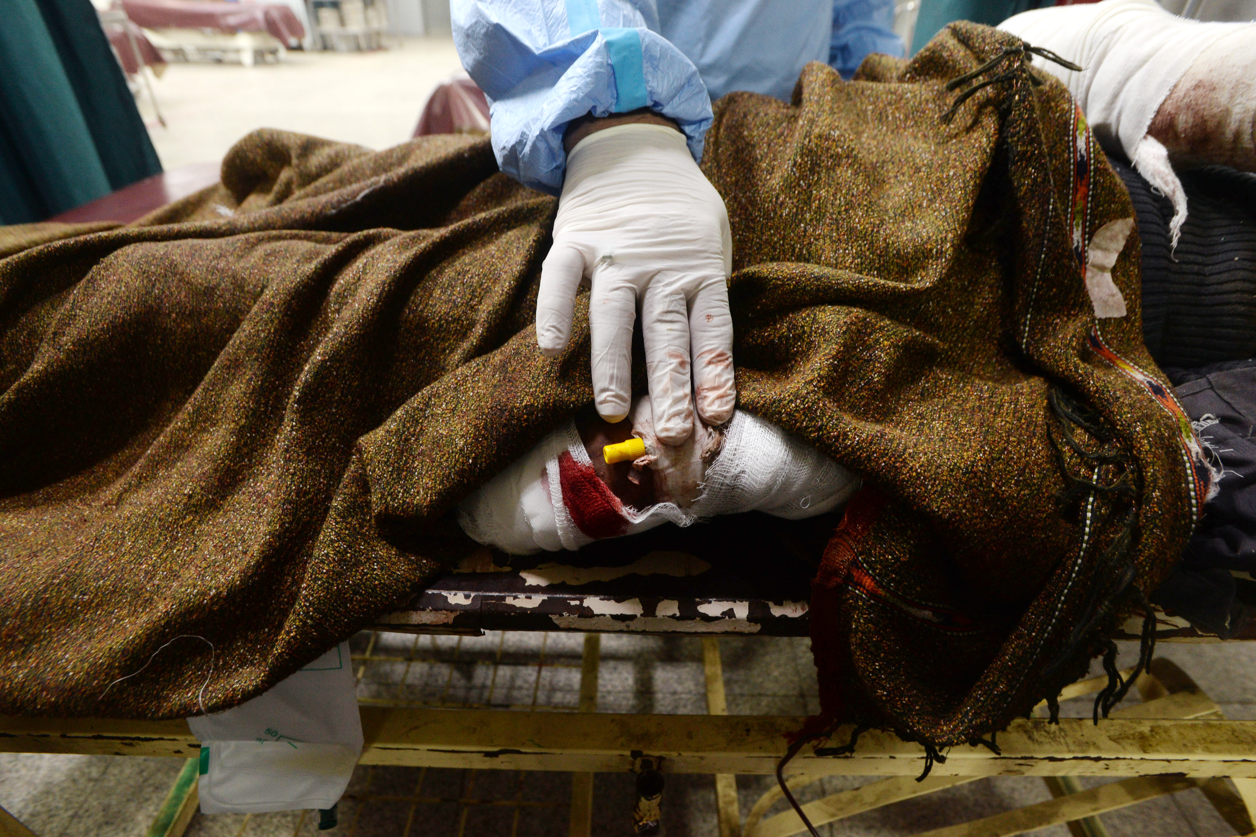 巴基斯坦发生炸弹袭击致6名警察死亡