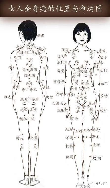 痣的位置图解 全身图片