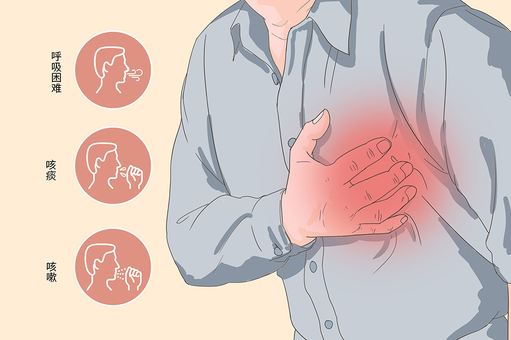 心绞痛病人的图片图片