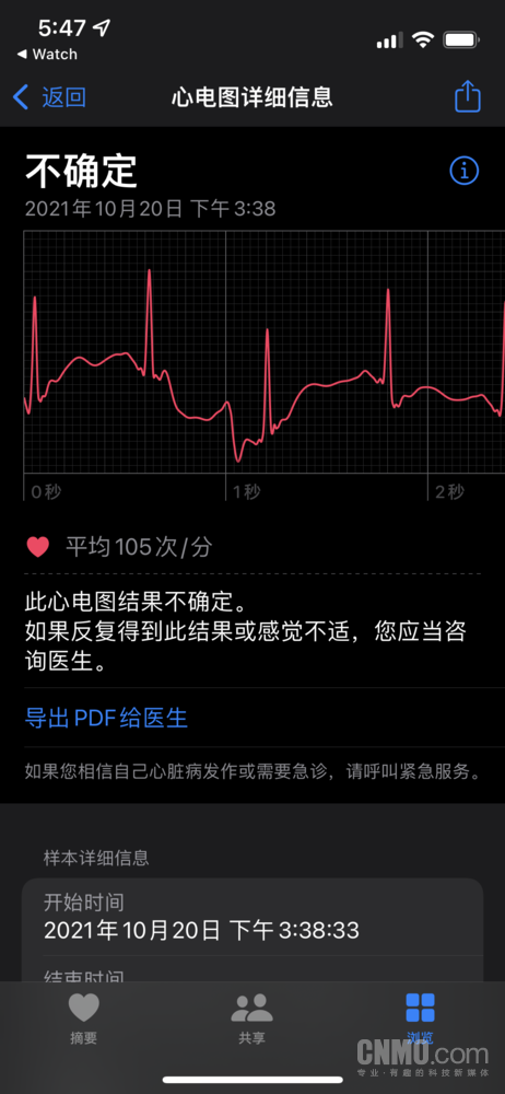 你的国行apple watch可以开通ecg了吗?我开了 你试试